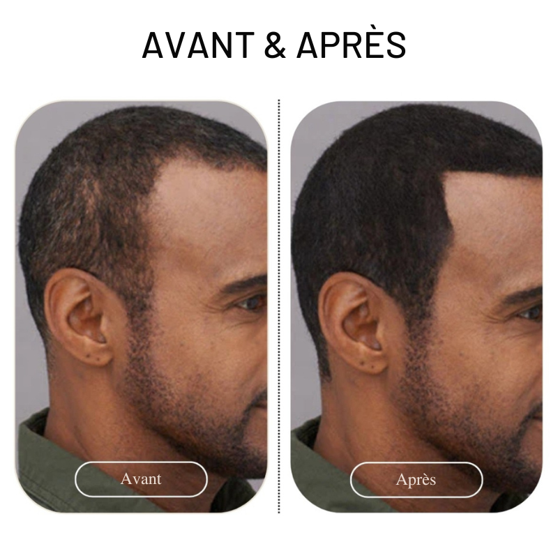 Kit 4 pièces Densy Hair® - Fibres capillaires densifiantes + Fixateur