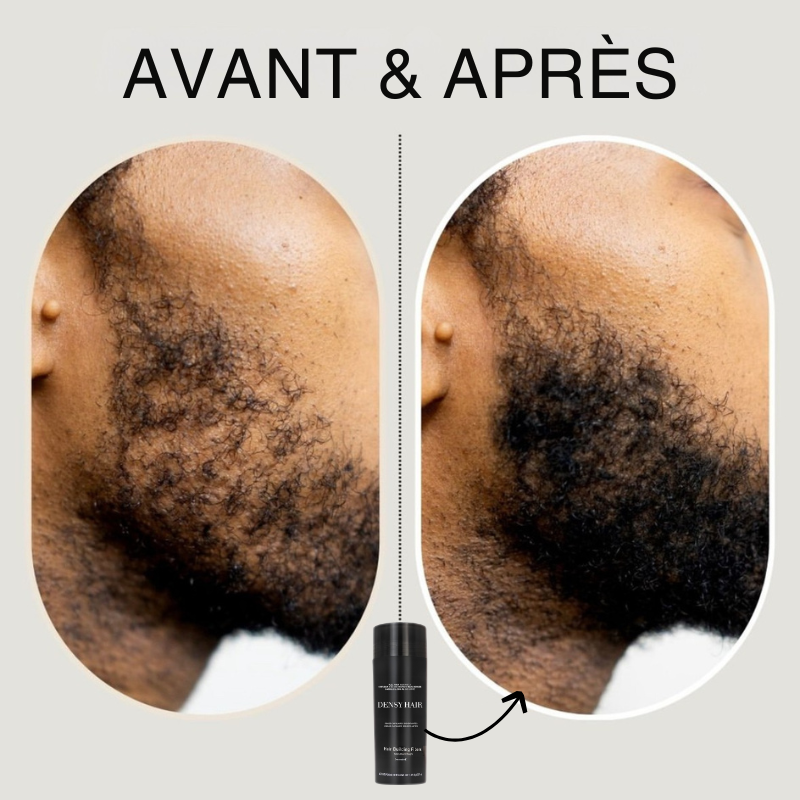 Kit 4 pièces Densy Hair® - Fibres capillaires densifiantes + Fixateur